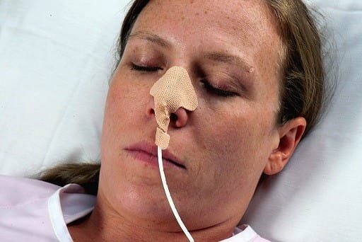 BEXEN Nasogastric Tube - Nazogastrik Kılavuz Telli Burundan Beslenme Sondası Silikon 12 FR - 1200 mm - Görsel 4